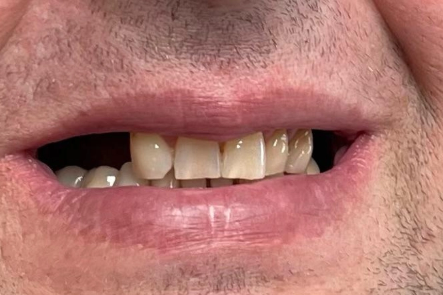Dental Hub - Studio dentistico ad Anzano e Arosio