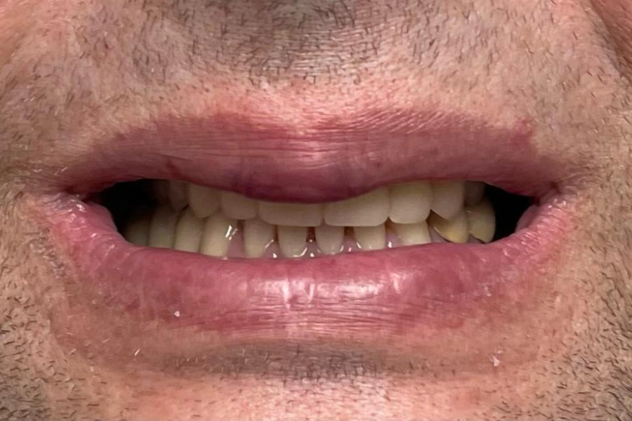 Dental Hub - Studio dentistico ad Anzano e Arosio