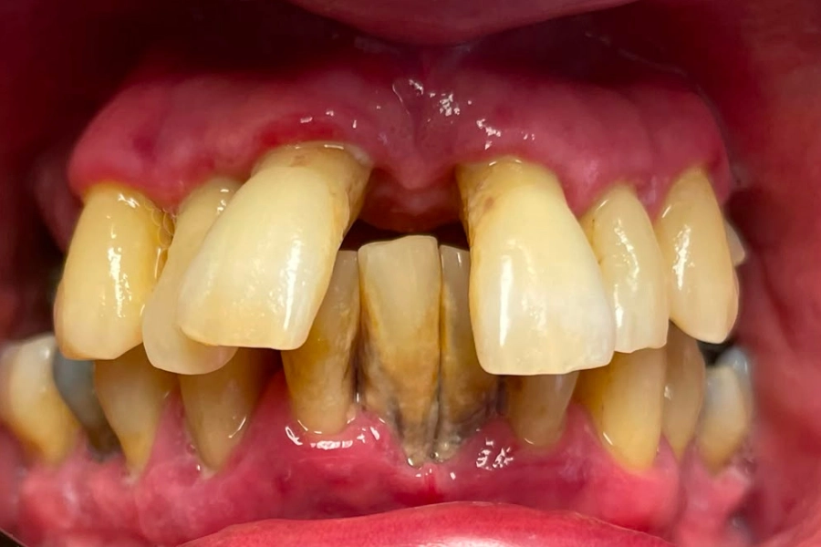 Dental Hub - Studio dentistico ad Anzano e Arosio