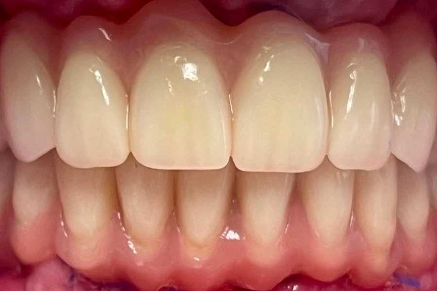 Dental Hub - Studio dentistico ad Anzano e Arosio