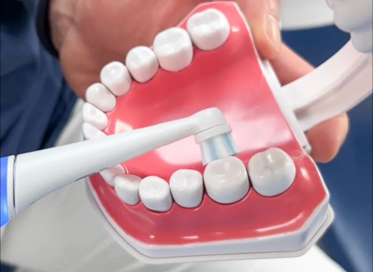 Ogni quanto fare la pulizia dentale
