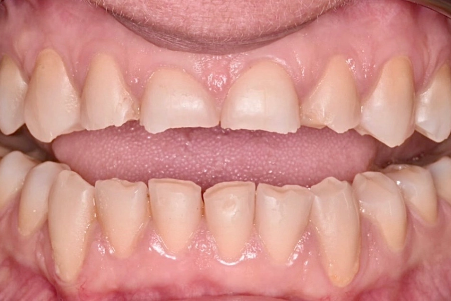Estetica dentale 3 - prima