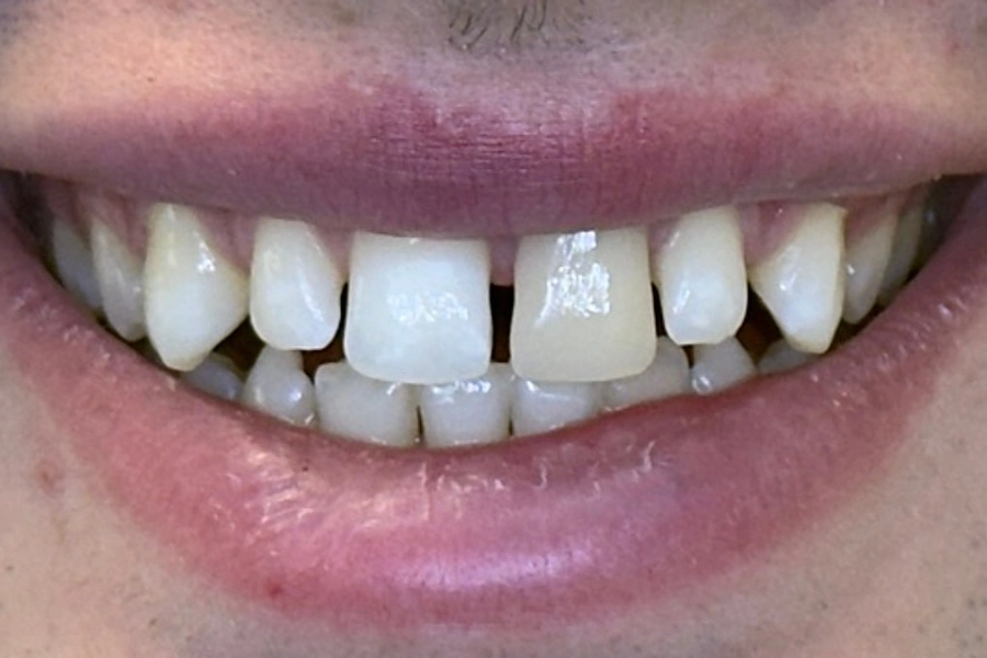 Estetica dentale 5 - prima